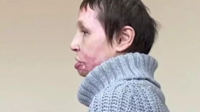 Φρίκη στη Ρωσία: Κάρφωσε τα χέρια και τα πόδια της συντρόφου του σε σανίδες και της έβαλε φωτιά, επειδή του ζήτησε να χωρίσουν