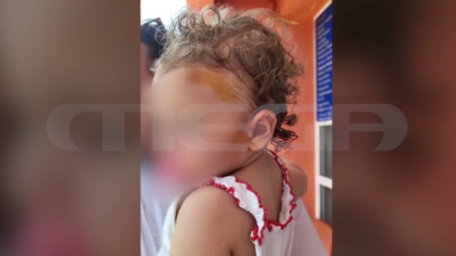Πρέβεζα: Αδέσποτος σκύλος επιτέθηκε σε μωρό στο κεφάλι μέσα σε κρεωπολείο